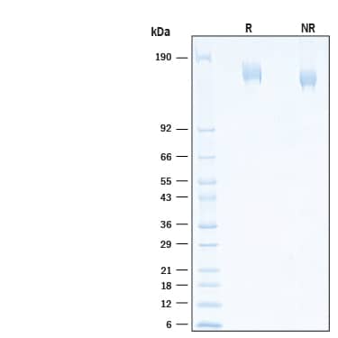 2 μg/lane of Recombinant SARS-CoV-2 Spike (GCN4-IZ) His-tag Alexa Fluor® 647 Protein (Catalog # AFR10561) was resolved with SDS-PAGE under reducing (R) and non-reducing (NR) conditions and visualized by Coomassie® Blue staining, showing bands at 144-175 kDa.