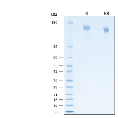 2 μg/lane of Recombinant SARS-CoV-2 P.1 Spike (GCN4-IZ) His-tag Alexa Fluor® 647 Protein (Catalog # AFR10795) was resolved with SDS-PAGE under reducing (R) and non-reducing (NR) conditions and visualized by Coomassie® Blue staining, showing bands at 140-170 kDa.