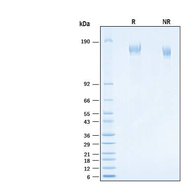 2 μg/lane of Recombinant SARS-CoV-2 S GCN4-IZ Alexa Fluor® 647 Protein (Catalog # AFR10796) was resolved with SDS-PAGE under reducing (R) and non-reducing (NR) conditions and visualized by Coomassie® Blue staining, showing bands at 140-170 kDa.