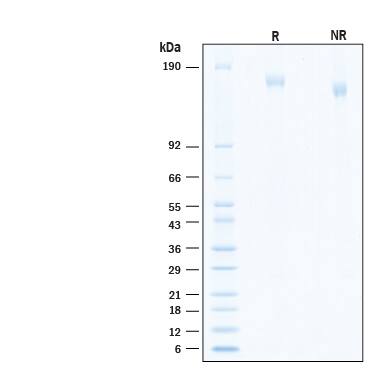 2 μg/lane of Recombinant SARS-CoV-2 B.1.1.529 Spike His-tag Alexa Fluor® 647 Protein (Catalog # AFR11060) was resolved with SDS-PAGE under reducing (R) and non-reducing (NR) conditions and visualized by Coomassie® Blue staining, showing bands at 156-176 kDa.