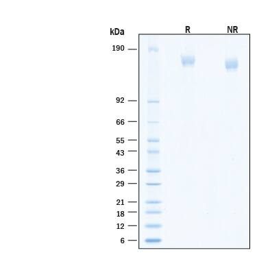 2 μg/lane of Recombinant SARS-CoV-2 B.1.1.529 Spike (GCN4-IZ) His-tag Alexa Fluor® 647 Protein (Catalog # AFR11061) was resolved with SDS-PAGE under reducing (R) and non-reducing (NR) conditions and visualized by Coomassie® Blue staining, showing bands at 145-175 kDa.