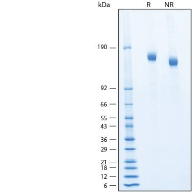 2 μg/lane of Recombinant SARS-CoV-2 BA.4/BA.5 S Alexa Fluor® 647 Protein (Catalog # AFR11231) was resolved with SDS-PAGE under reducing (R) and non-reducing (NR) conditions and visualized by Coomassie® Blue staining, showing bands at 141-170 kDa.