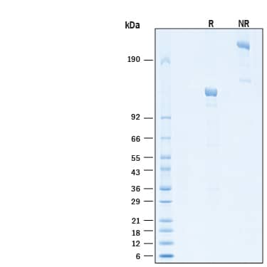 2 μg/lane of Recombinant Human Siglec‑2/CD22 Fc Chimera Alexa Fluor® 647 Protein (Catalog # AFR1968) was resolved with SDS-PAGE under reducing (R) and non-reducing (NR) conditions and visualized by Coomassie® Blue staining, showing bands at 120-132 kDa and 240-260 kDa, respectively.