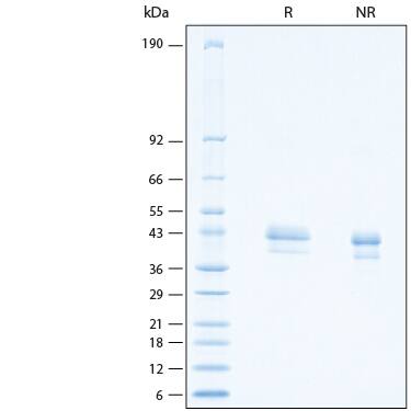 2 μg/lane of Recombinant Human Mesothelin C-Terminal (aa 296‑580) His‑tag Alexa Fluor® 647 Protein (Catalog # AFR3265) was resolved with SDS-PAGE under reducing (R) and non-reducing (NR) conditions and visualized by Coomassie® Blue staining, showing bands at 37-45 kDa.