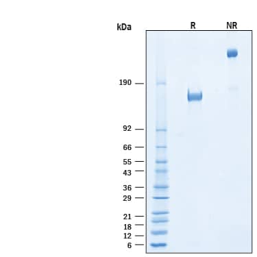 2 μg/lane of Recombinant Human VEGFR2/KDR Fc His Alexa Fluor® 647 Protein (Catalog # AFR357) was resolved with SDS-PAGE under reducing (R) and non-reducing (NR) conditions and visualized by Coomassie® Blue staining, showing bands at 150-170 kDa and 300-340 kDa, respectively.