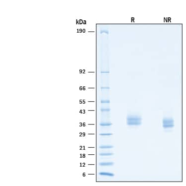 2 μg/lane of Recombinant Human PD-L1/B7-H1 His-tag Alexa Fluor® 647 Protein (Catalog # AFR9049) was resolved with SDS-PAGE under reducing (R) and non-reducing (NR) conditions and visualized by Coomassie® Blue staining, showing bands at 31-42 kDa.