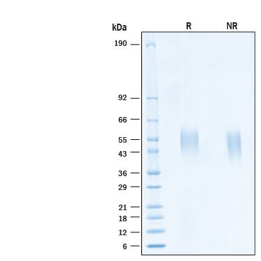 2 μg/lane of Recombinant Human B7‑1/CD80 His-tag Alexa Fluor® 647 Protein (Catalog # AFR9050) was resolved with SDS-PAGE under reducing (R) and non-reducing (NR) conditions and visualized by Coomassie® Blue staining, showing bands at 45‑58 kDa.