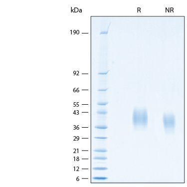 2 μg/lane of Recombinant Human PD-L2/B7-DC His-tag Alexa Fluor® 647 Protein (Catalog # AFR9075) was resolved with SDS-PAGE under reducing (R) and non-reducing (NR) conditions and visualized by Coomassie® Blue staining, showing bands at 29-47 kDa.