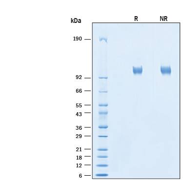 2 μg/lane of Recombinant Human ACE-2 His-tag Alexa Fluor® 647 Protein (Catalog # AFR933) was resolved with SDS-PAGE under reducing (R) and non-reducing (NR) conditions and visualized by Coomassie® Blue staining, showing bands at 101-111 kDa.