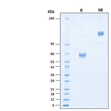 2 μg/lane of Recombinant Human EMMPRIN/CD147 Fc Chimera His-tag Alexa Fluor® 647 Protein (Catalog # AFR972) was resolved with SDS-PAGE under reducing (R) and non-reducing (NR) conditions and visualized by Coomassie® Blue staining, showing bands at 56-69 kDa and 112-140 kDa, respectively.