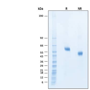 2 μg/lane of Recombinant Human DLL3 His-tag Alexa Fluor® 647 Protein (Catalog # AFR9749) was resolved with SDS-PAGE under reducing (R) and non-reducing (NR) conditions and visualized by Coomassie® Blue staining, showing bands at 52-62 kDa.