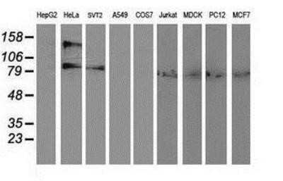 Western Blot: alcohol dehydrogenase 1B Antibody (OTI4F12) - Azide and BSA Free [NBP2-70092] - Analysis of extracts (35ug) from 9 different cell lines by using anti-alcohol dehydrogenase 1B monoclonal antibody.