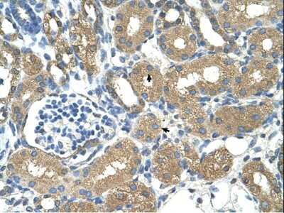 Immunohistochemistry: alcohol dehydrogenase 4 Antibody [NBP3-10572] - Immunohistochemical analysis of fetal liver cell lysate tissue at an antibody concentration of 1.25 ug/ml.