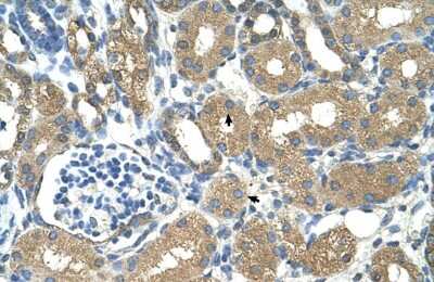 Immunohistochemistry-Paraffin: alcohol dehydrogenase 4 Antibody [NBP1-53173] - Human kidney Tissue, antibody concentration 4-8ug/ml. Cells with positive label: renal corpuscle cells (indicated with arrows) 400X magnification.