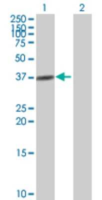 Western Blot: alcohol dehydrogenase 4 Antibody [H00000127-B01P] - Analysis of ADH4 expression in transfected 293T cell line by ADH4 polyclonal antibody.  Lane 1: ADH4 transfected lysate(41.8 KDa). Lane 2: Non-transfected lysate.