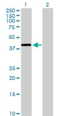 Western Blot: alcohol dehydrogenase 4 Antibody [H00000127-D01P] - Analysis of ADH4 expression in transfected 293T cell line by ADH4 polyclonal antibody.Lane 1: ADH4 transfected lysate(40.20 KDa).Lane 2: Non-transfected lysate.