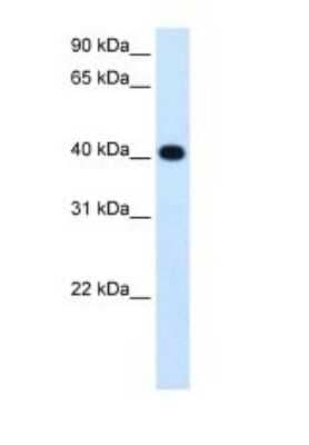 Western Blot: alcohol dehydrogenase 4 Antibody [NBP1-53173] - Titration: 1.25ug/ml Positive Control: Fetal liver cell lysate.