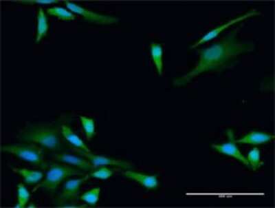 Immunocytochemistry/Immunofluorescence: alcohol dehydrogenase 5 Antibody [H00000128-D01P] - Analysis of antibody to ADH5 on HeLa cell. Antibody concentration 20 ug/ml.