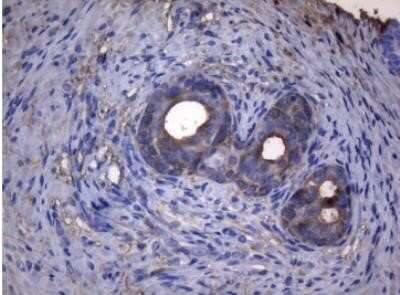 Immunohistochemistry: alcohol dehydrogenase 5 Antibody (OTI5G4) - Azide and BSA Free [NBP2-70096] - Staining of paraffin-embedded Human prostate tissue within the normal limits using anti-ADH5 mouse monoclonal antibody. (Heat-induced epitope retrieval by 1mM EDTA in 10mM Tris buffer (pH8.5) at 120 degrees C for 3 min, 1:150)