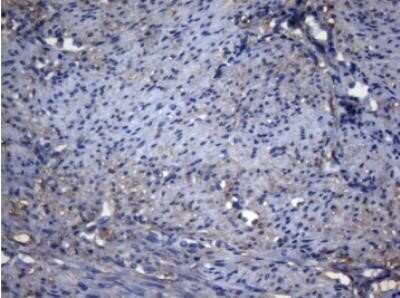 Immunohistochemistry: alcohol dehydrogenase 5 Antibody (OTI5G4) - Azide and BSA Free [NBP2-70096] - Staining of paraffin-embedded Human endometrium tissue within the normal limits using anti-ADH5 mouse monoclonal antibody. (Heat induced epitope retrieval by 1mM EDTA in 10mM Tris buffer (pH8.5) at 120 degrees C for 3 min, (1:150)