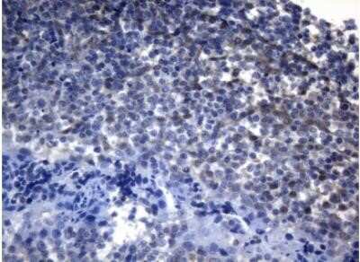 Immunohistochemistry: alcohol dehydrogenase 5 Antibody (OTI5G4) - Azide and BSA Free [NBP2-70096] - Staining of paraffin-embedded Human tonsil within the normal limits using anti-ADH5 mouse monoclonal antibody.(Heat-induced epitope retrieval by 1mM EDTA in 10mM Tris buffer (pH8.5) at 120 degrees C for 3 min, (1:150)