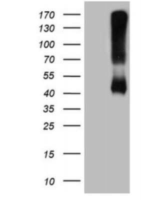 Western Blot: alcohol dehydrogenase 5 Antibody (OTI5G4) - Azide and BSA Free [NBP2-70096] - HEK293T cells were transfected with the pCMV6-ENTRY control (Left lane) or pCMV6-ENTRY ADH5 (Right lane) cDNA for 48 hrs and lysed. Equivalent amounts of cell lysates (5 ug per lane) were separated by SDS-PAGE and immunoblotted with antiADH5.(1:2000)