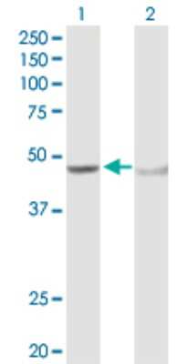 Western Blot: alcohol dehydrogenase 5 Antibody [H00000128-D01P] - Analysis of ADH5 expression in transfected 293T cell line by ADH5 polyclonal antibody.Lane 1: ADH5 transfected lysate(39.70 KDa).Lane 2: Non-transfected lysate.