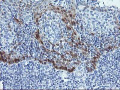 Immunohistochemistry: alcohol dehydrogenase 7 Antibody (OTI2H10) - Azide and BSA Free [NBP2-70098] - Staining of paraffin-embedded Human tonsil using anti-alcohol dehydrogenase 7 mouse monoclonal antibody.