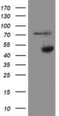 Western Blot: alcohol dehydrogenase 7 Antibody (OTI2H10) - Azide and BSA Free [NBP2-70098] - HEK293T cells were transfected with the pCMV6-ENTRY control (Left lane) or pCMV6-ENTRY alcohol dehydrogenase 7 (Right lane) cDNA for 48 hrs and lysed. Equivalent amounts of cell lysates (5 ug per lane) were separated by SDS-PAGE and immunoblotted with ant