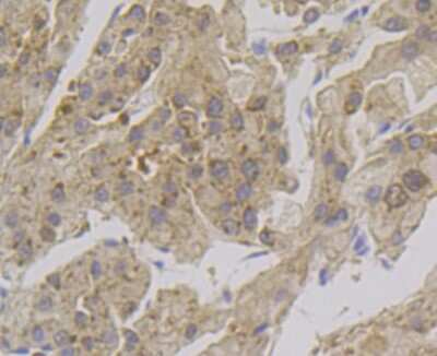 Immunohistochemistry-Paraffin: alcohol dehydrogenase Antibody (JG82-31) [NBP2-75398] - Analysis of paraffin-embedded human liver tissue using anti-Alcohol Dehydrogenase antibody. Counter stained with hematoxylin.
