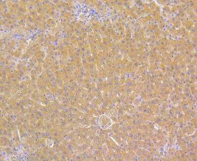 Immunohistochemistry: alpha 1-Acid Glycoprotein Antibody (A2-B10) [NBP2-76901] - Immunohistochemical analysis of paraffin-embedded rat liver tissue using anti- Alpha-1-acid glycoprotein antibody. Counter stained with hematoxylin.