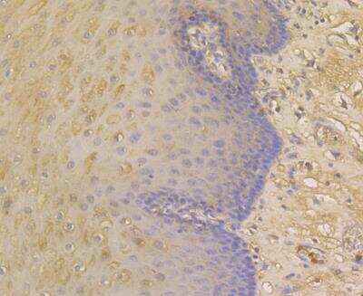 Immunohistochemistry: alpha 1-Acid Glycoprotein Antibody (A2-B10) [NBP2-76901] - Immunohistochemical analysis of paraffin-embedded human esophagus tissue using anti- Alpha-1-acid glycoprotein antibody. Counter stained with hematoxylin.