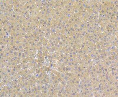 Immunohistochemistry: alpha 1-Acid Glycoprotein Antibody (A4-G2-A3) [NBP2-76902] - Immunohistochemical analysis of paraffin-embedded rat liver tissue using anti- Alpha-1-acid glycoprotein antibody. Counter stained with hematoxylin.