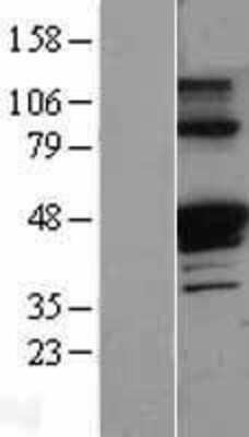 Western Blot: alpha 1 Antitrypsin Overexpression Lysate (Adult Normal) [NBL1-15833] Left-Empty vector transfected control cell lysate (HEK293 cell lysate); Right -Over-expression Lysate for alpha 1 Antitrypsin.