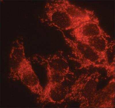 Immunocytochemistry/ Immunofluorescence alpha 1 Mannosidase 1A Antibody