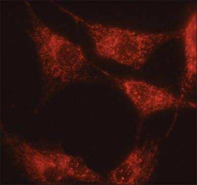 Immunocytochemistry/ Immunofluorescence alpha 1 Mannosidase 1A Antibody