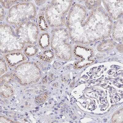 Immunohistochemistry-Paraffin: alpha 1 Mannosidase 1A Antibody [NBP2-37938] - Staining of human kidney shows moderate to strong positivity in Golgi apparatus in cells in tubules.