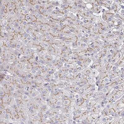 Immunohistochemistry-Paraffin: alpha 1 Mannosidase 1A Antibody [NBP2-37938] - Staining of human liver shows moderate positivity in bile canaliculi.