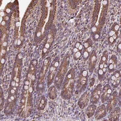 Immunohistochemistry-Paraffin alpha 1 Mannosidase 1A Antibody - BSA Free