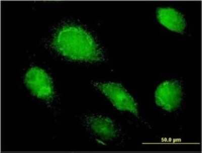 Immunocytochemistry/Immunofluorescence: alpha 1-Microglobulin Antibody (3F1) [H00000259-M01] - Analysis of monoclonal antibody to AMBP on HeLa cell. Antibody concentration 10 ug/ml.