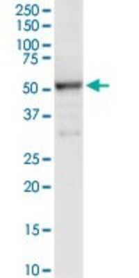 Western Blot: alpha 1-Microglobulin Antibody [H00000259-D01P] - Analysis of AMBP expression in human colon.