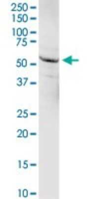 Western Blot: alpha 1-Microglobulin Antibody [H00000259-D01P] - Analysis of AMBP expression in rat brain.