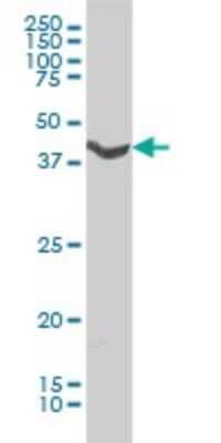 Western Blot: alpha-1A Adrenergic R/ADRA1A Antibody (4C7) [H00000148-M01] - ADRA1A monoclonal antibody (M01), clone 4C7 Analysis of ADRA1A expression in HL-60.