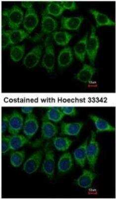 Immunocytochemistry/Immunofluorescence: alpha-1A Adrenergic R/ADRA1A Antibody [NB100-78585] - analysis of methanol-fixed Hep3B, using alpha 1a Adrenergic Receptor antibody at 1:500 dilution.