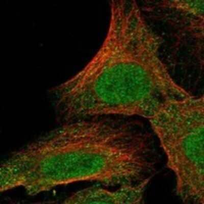 Immunocytochemistry/Immunofluorescence: alpha-1A Adrenergic R/ADRA1A Antibody [NBP3-17211] - Staining of human cell line U-2 OS shows localization to nucleoplasm & cytosol.