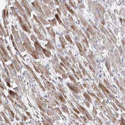 Immunohistochemistry: alpha-1A Adrenergic R/ADRA1A Antibody [NBP1-90228] - Staining of human heart muscle shows moderate cytoplasmic positivity in subsets of myocytes.