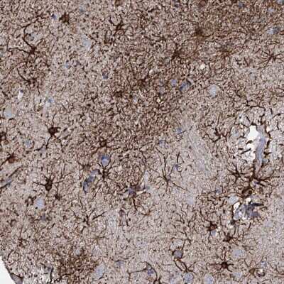 Immunohistochemistry: alpha-1A Adrenergic R/ADRA1A Antibody [NBP2-38145] - Staining of human lateral ventricle shows strong cytoplasmic positivity in astrocytes.