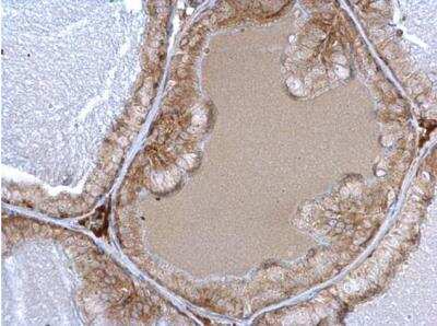 Immunohistochemistry-Paraffin: alpha-1A Adrenergic R/ADRA1A Antibody [NB100-78585] - Mouse prostate. alpha 1a Adrenergic Receptor antibody dilution: 1:500. Antigen Retrieval: Trilogy™ (EDTA based, pH 8.0) buffer, 15min.