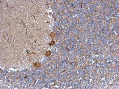 Immunohistochemistry-Paraffin: alpha-1A Adrenergic R/ADRA1A Antibody [NB100-78585] - Rat hind brain. alpha 1a Adrenergic Receptor antibody dilution: 1:500. Antigen Retrieval: Trilogy™ (EDTA based, pH 8.0) buffer, 15min.