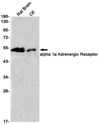 Western Blot: alpha-1A Adrenergic R/ADRA1A Antibody (S04-8B8) [NBP3-19566] - Western blot detection of alpha-1A Adrenergic R/ADRA1A in Rat Brain, C6 cell lysates using NBP3-19566 (1:1000 diluted). Predicted band size: 52KDa. Observed band size: 52KDa.